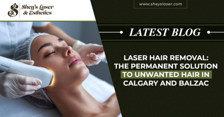 Laser Hair Removal: The Permanent Solution to Unwanted Hair in Calgary and Balzac
