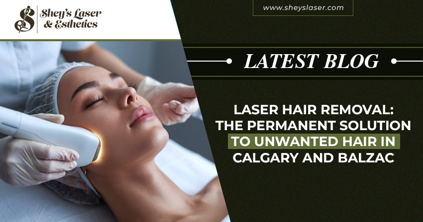 Laser Hair Removal: The Permanent Solution to Unwanted Hair in Calgary and Balzac